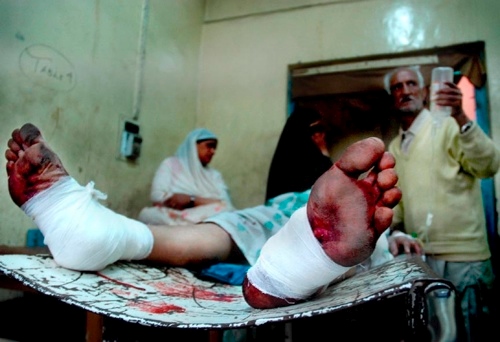Injured Injured